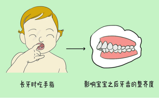 西安军海口腔——儿童哪些牙颌面畸形需要矫治